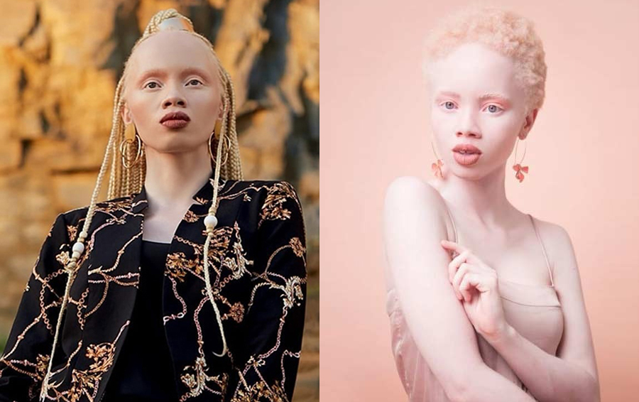 Рожденные быть другими: ТОП-5 самых известных моделей-альбиносов