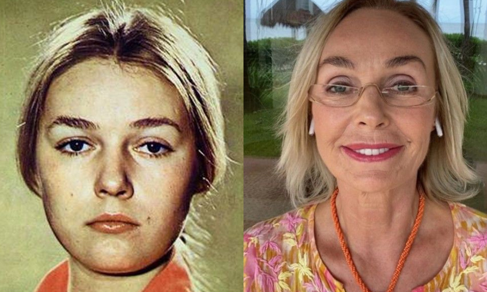 Андрейченко до и после пластики фото