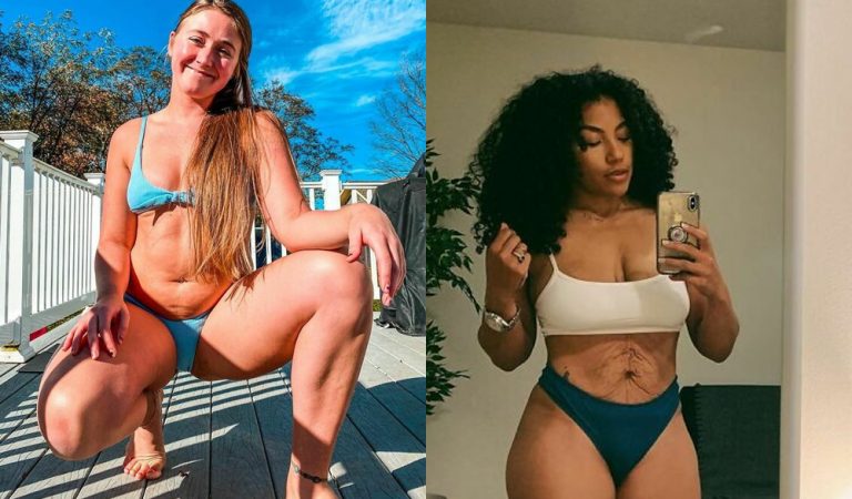 Красота по-новому: 10 женщин показали, как на самом деле выглядят их тела